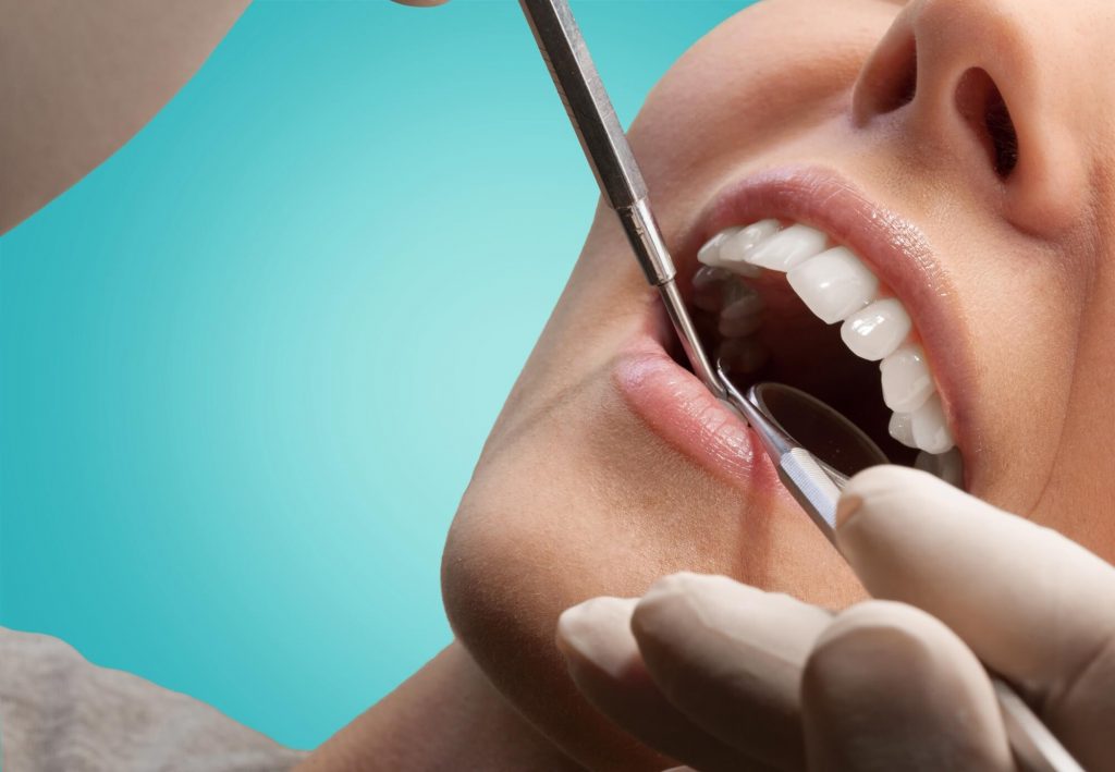 what is a sedation dentistry Greenville SC?