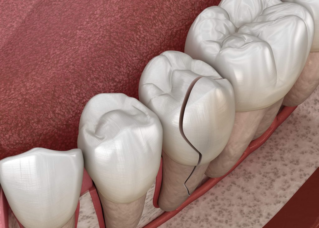 Where can I find an Emergency Dentist Greenville SC?