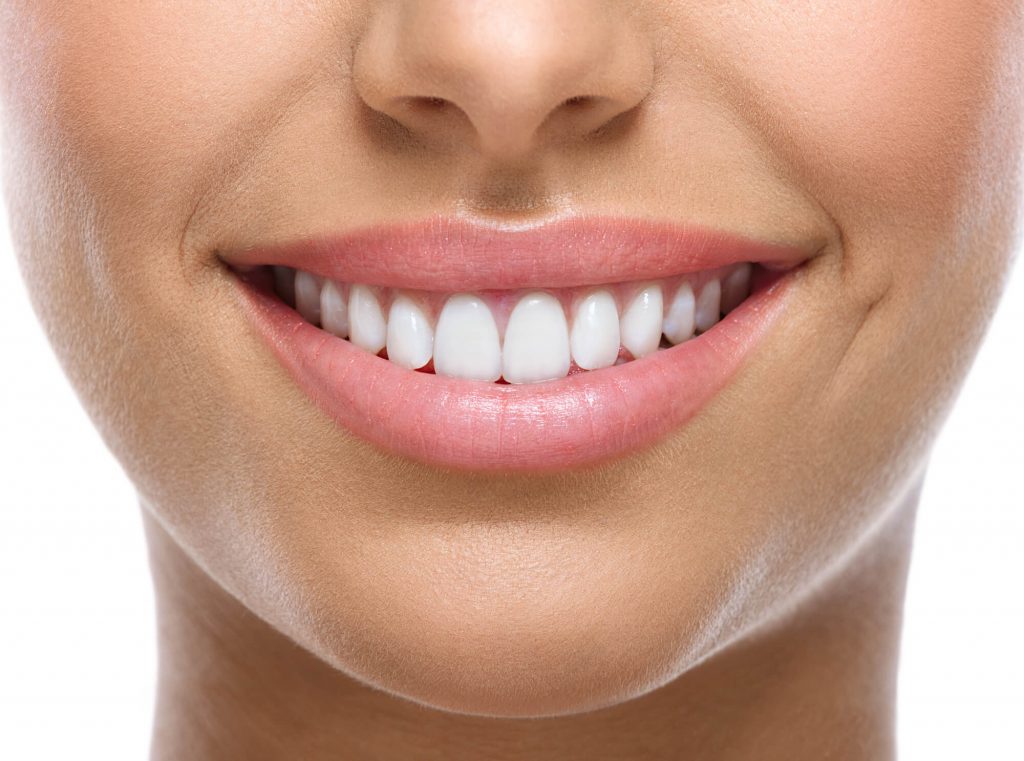 where can I get veneers in simpsonville sc?