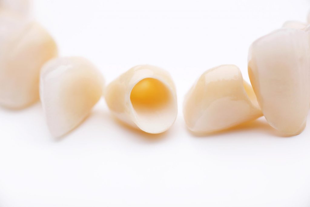 What are dental crowns Simpsonville SC?