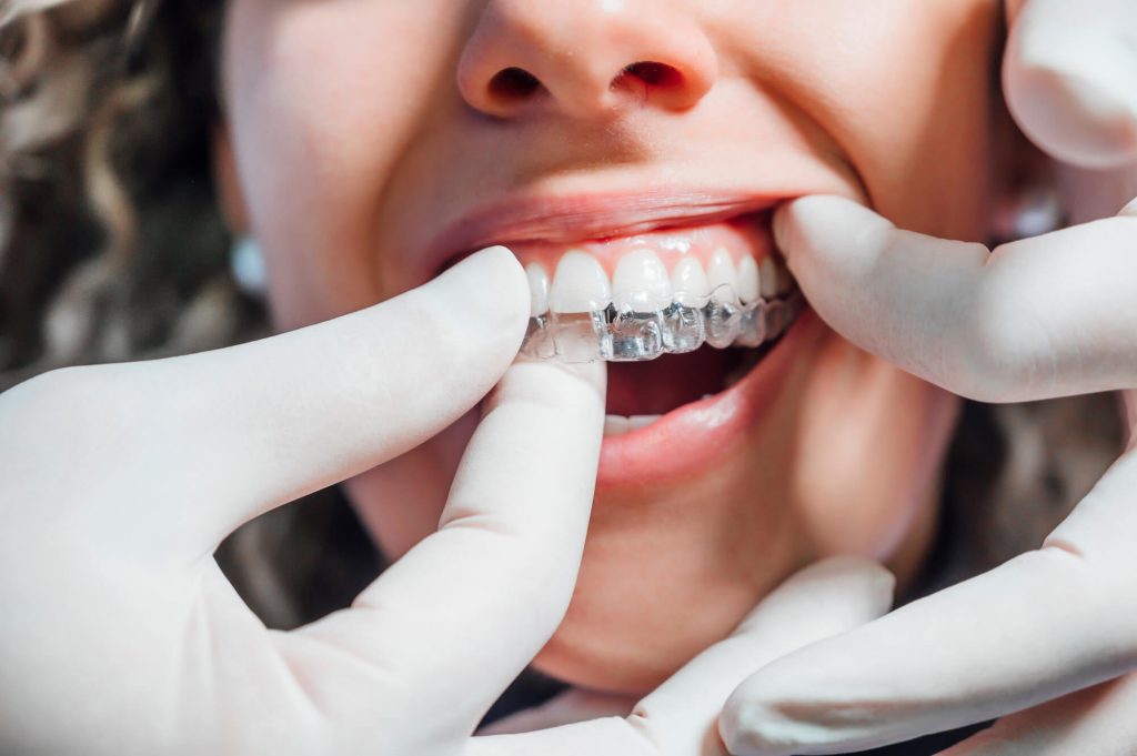 Patient at dentist office getting Invisalign Simpsonville SC  