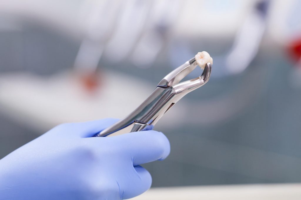 wisdom teeth procedure Greenville SC