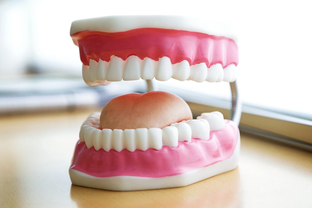 sample of dentures in Greenville SC