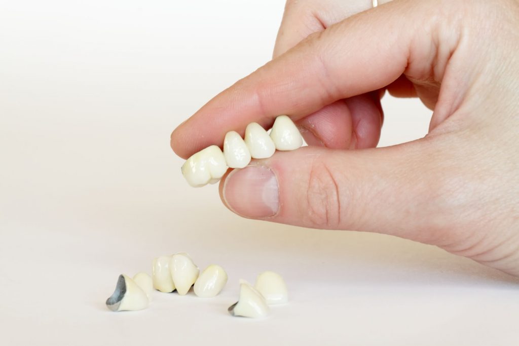 dentist holding crowns in Simpsonville SC