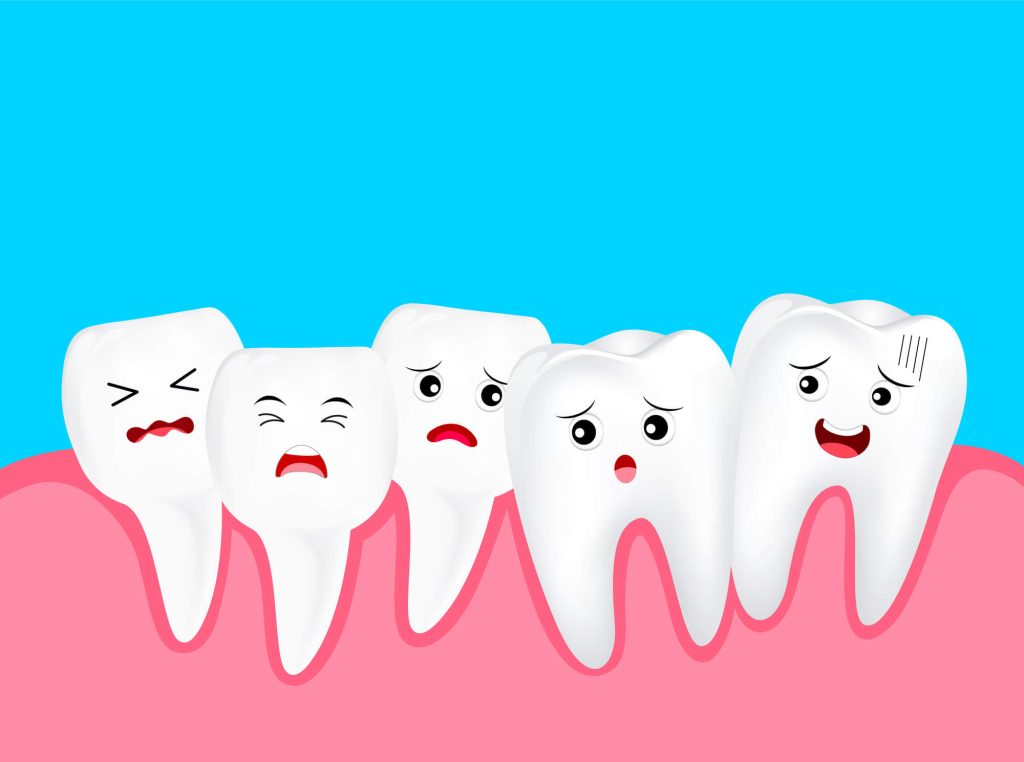 crooked teeth image showing the need for Invisalign in Greenville SC
