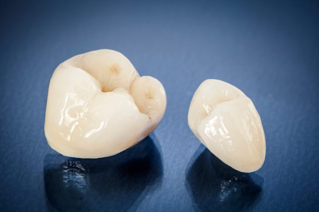 dental crowns in Greenville SC over blue surface