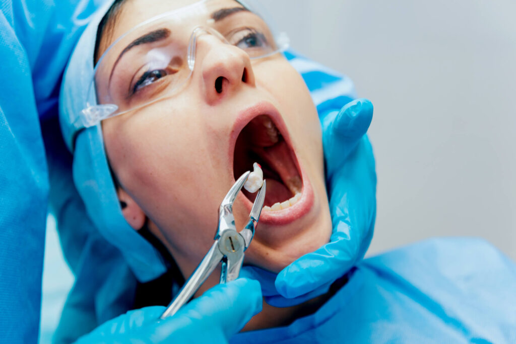 successful tooth extractions Simpsonville SC